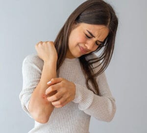 The Best Ayurvedic Herbs for Skin Allergy Relief