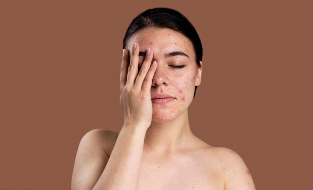 antimicrobial properties of Ashwagandha