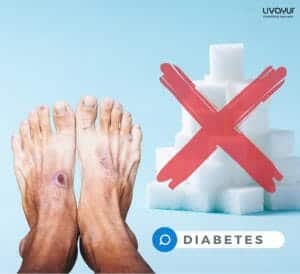 Here’s How Diabetics Can Lead To Foot Ulcers