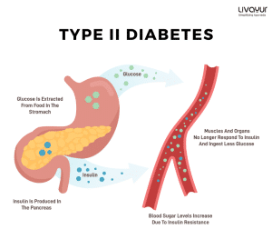 Type 2 Diabetes: What is it, Symptoms, Causes, Risk Factors & Treatment