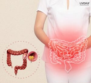 What is colorectal cancer:  definition, symptoms, causes, risk factors & more