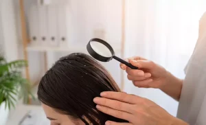 8 Effective Home Remedies To Remove Lice Naturally at Home