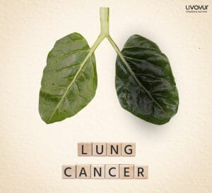 Lung Cancer: Symptoms, Causes, Types, Stages & Treatment
