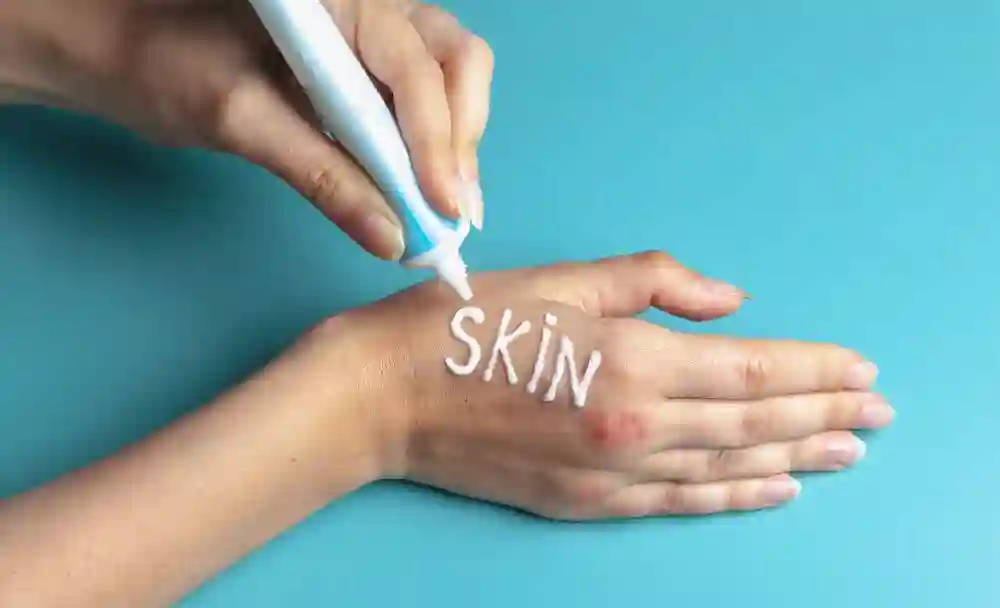 scleroderma - livayur