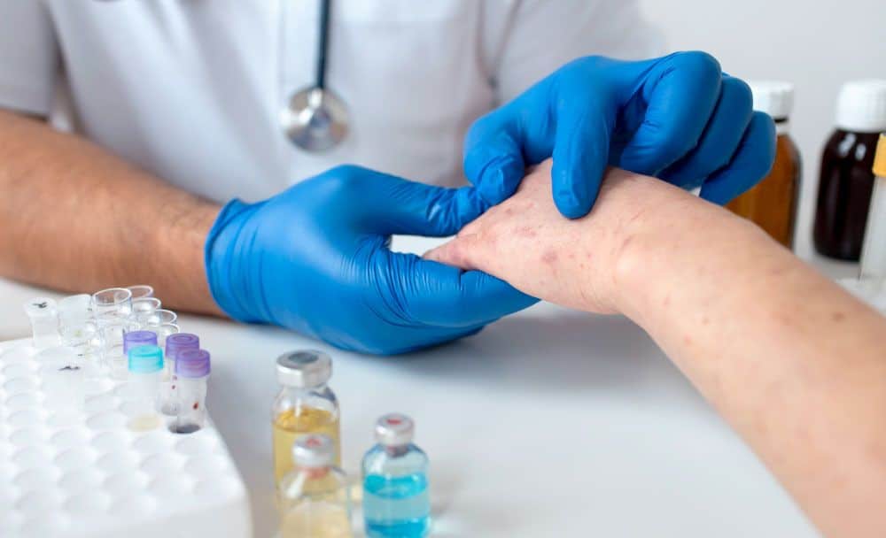 skin rash prevention