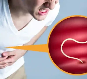 Intestinal Worms: Symptoms, Causes, Diagnosis & Treatment