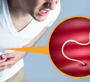 stomach worms - livayur