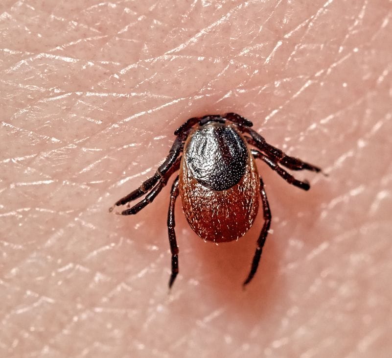 lyme disease - livayur