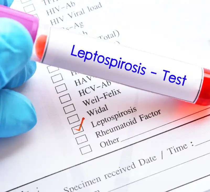 leptospirosis - livayur