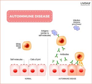 Autoimmune Disease: Causes, Symptoms, Types, Treatment & More