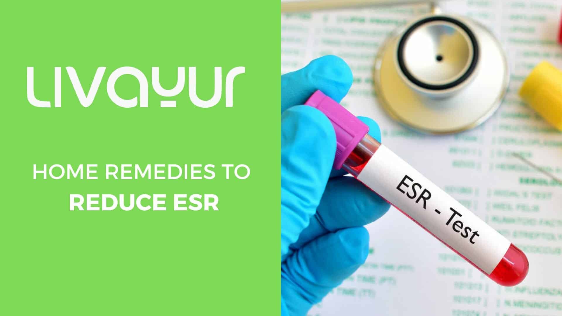 Learn Everything You Need To Know About The ESR Parameter As A Indicator Of The Body’s Wellbeing Thumbnail