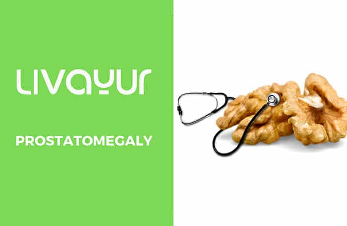 Prostatomegaly: Symptoms, Causes, and Ayurvedic Approach Thumbnail