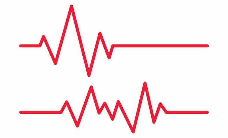 echocardiogram