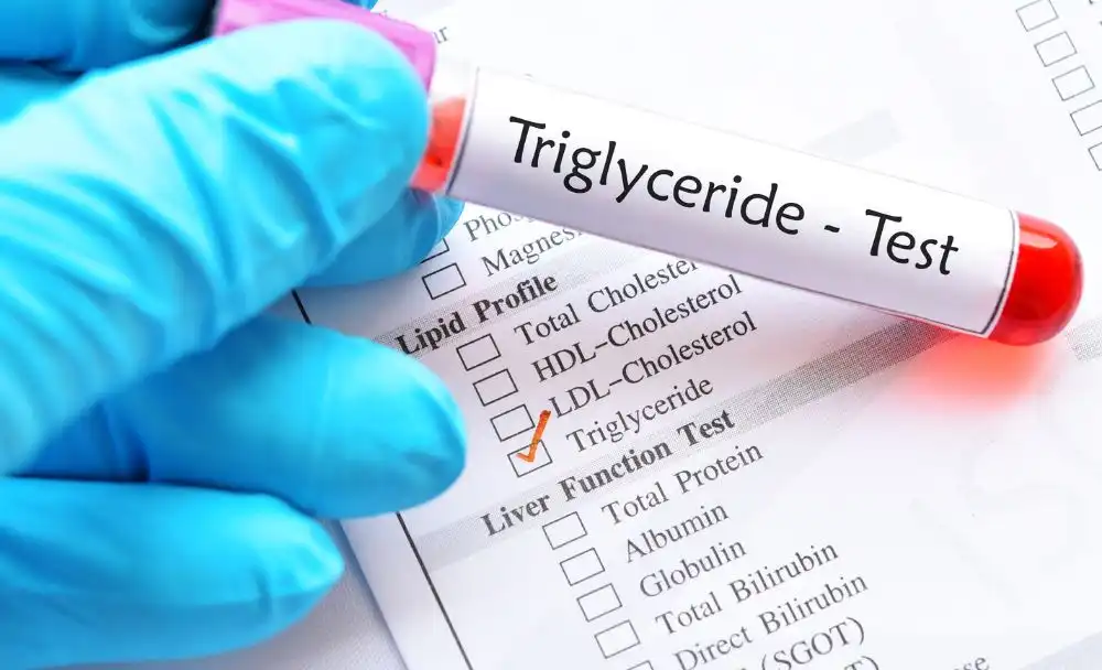 91-1 High Triglycerides Causes