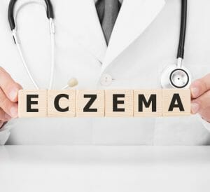 What are the signs and Symptoms of Eczema