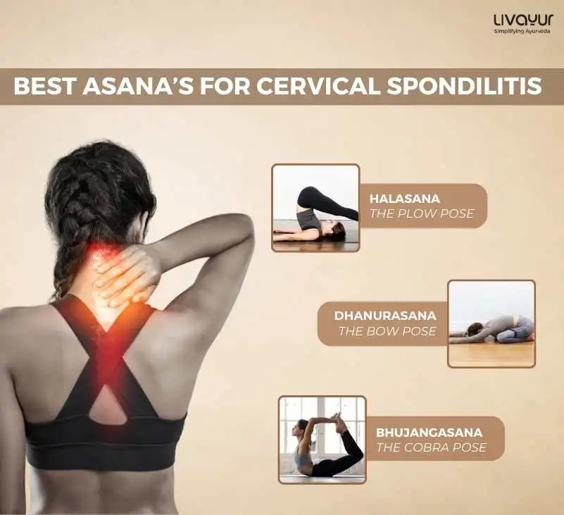 10 Best Exercises to Relieve cervical spondylosis