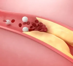 15 Best Foods to Lower Cholesterol Naturally