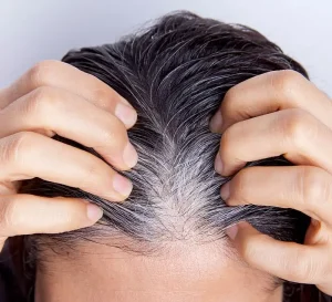 8 Effective Home Remedies to Treat Grey Hair Naturally