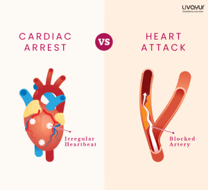Cardiac Arrest What is Cardiac Arrest Causes Symptoms Treatment Prevention