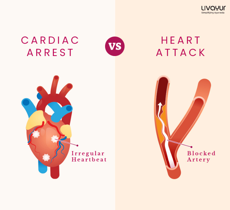 Cardiac Arrest: What is Cardiac Arrest, Causes, Symptoms, Treatment & Prevention