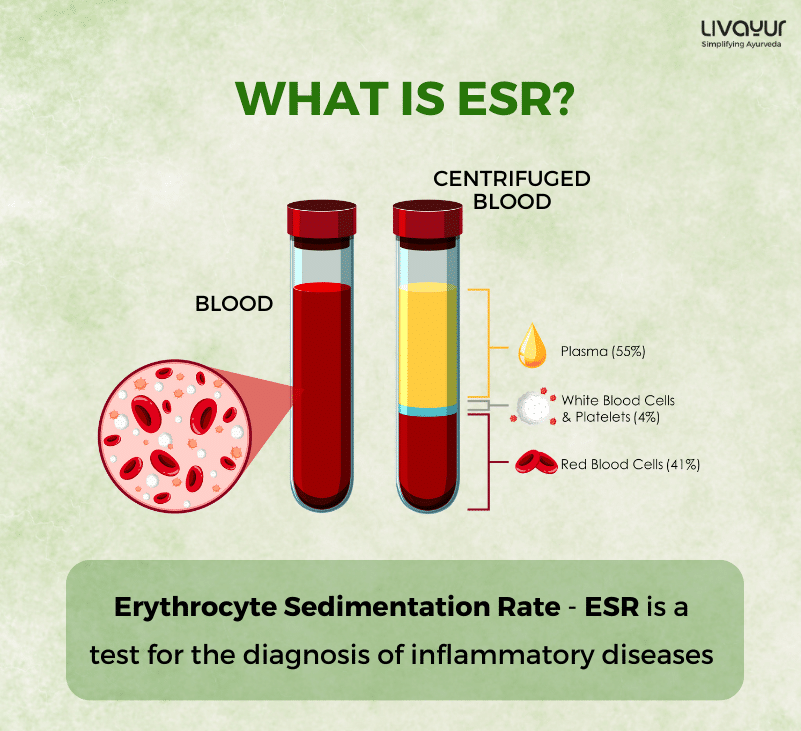 What is ESR Normal Range Causes Diagnosis Treatment 3