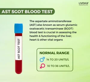 AST SGOT Blood Test: High and Normal Range