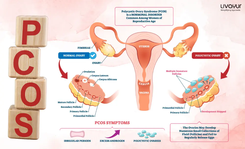 what size of ovarian cyst is dangerous